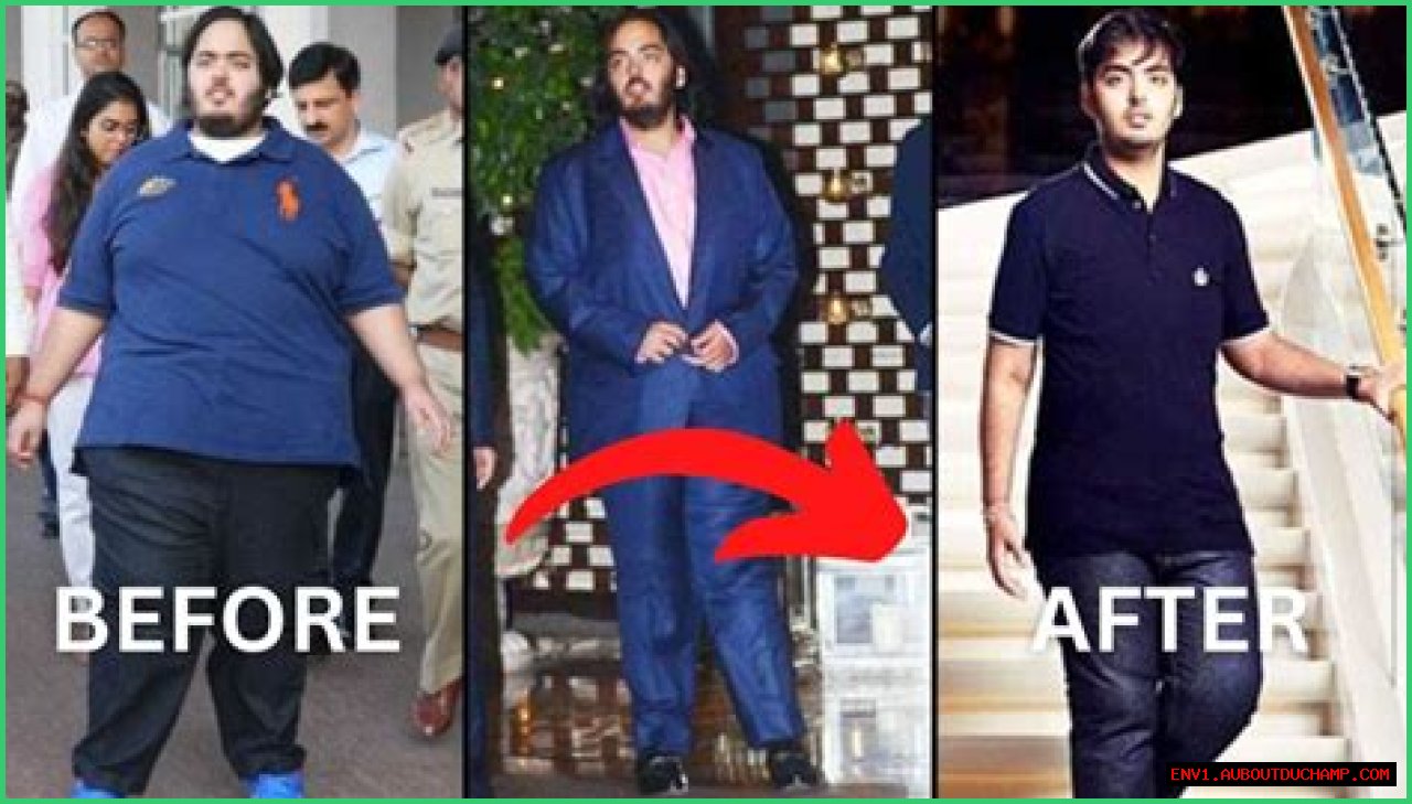 Anant Ambani's Journey: Battling A Rare Disease With Courage
