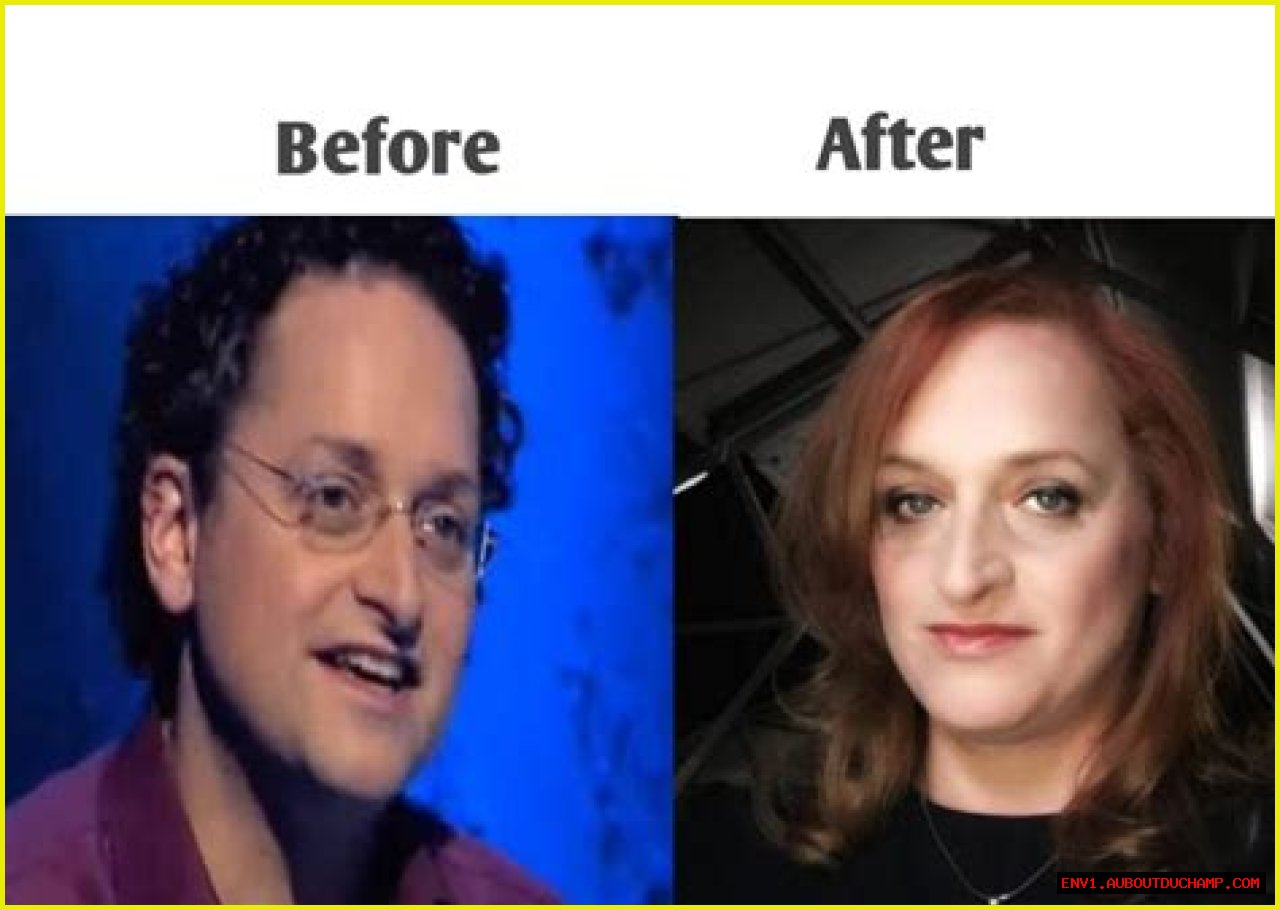 Dr. Lynette Nusbacher Before And After: A Journey Of Transformation