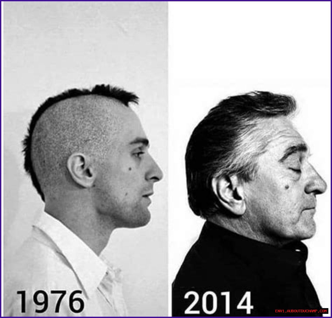 Understanding The De Niro Ear: A Comprehensive Guide